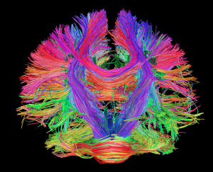 Image of underside of brain from the Human Connectome Project